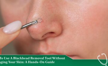 how to use blackhead removal tool