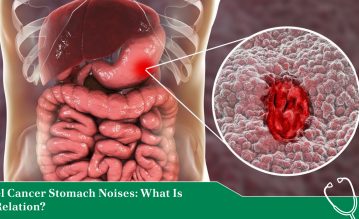 bowel cancer stomach noises