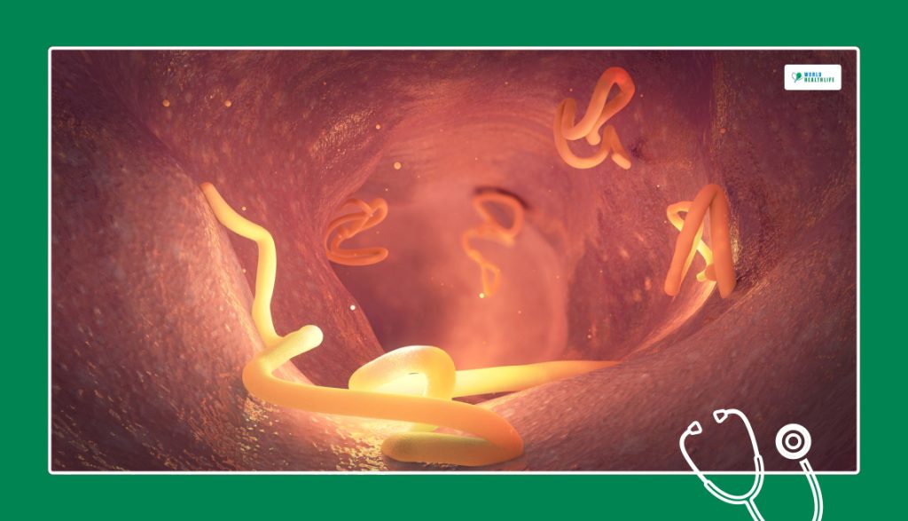 How To Diagnose And Treat Gastrointestinal Parasites