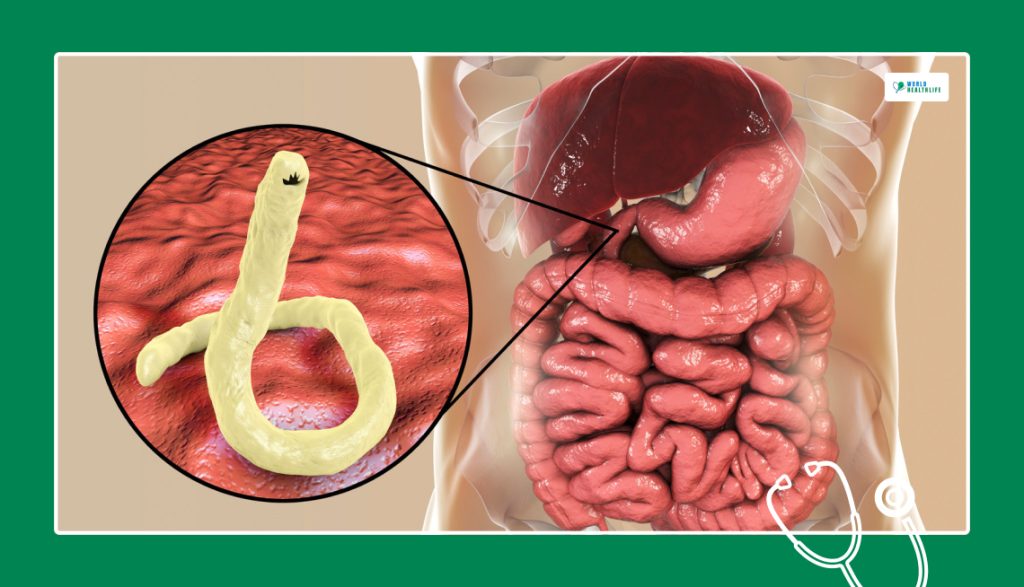 What Are The Different Types Of Intestinal Parasites