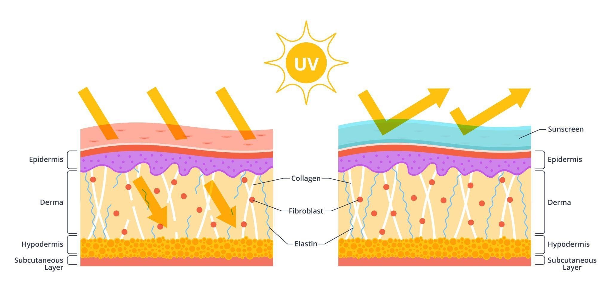 Schedule An Appointment With A Dermatologist If You See Signs Of Damaged Skin Barrier