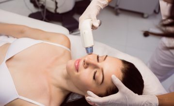 laser skin resurfacing in florida