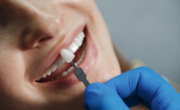 Dental Implant
