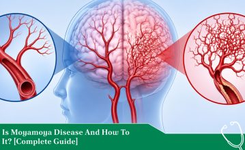 what is Moyamoya disease