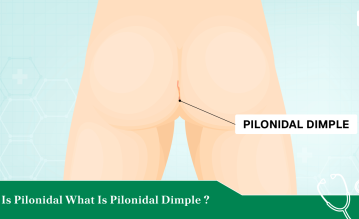 pilonidal dimple