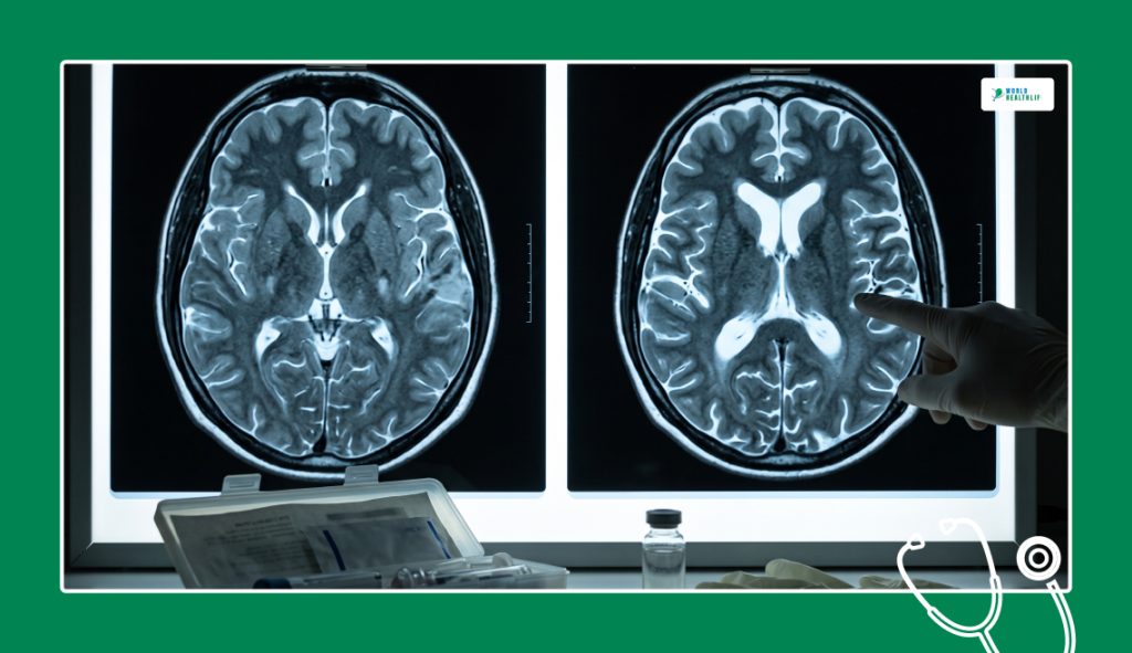 Finding the Visual Evidence_ Diagnosis and MRI Changes