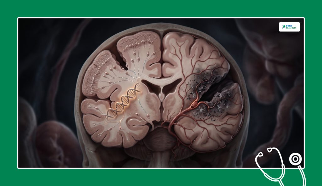 Genetic Triggers And Vascular Insults