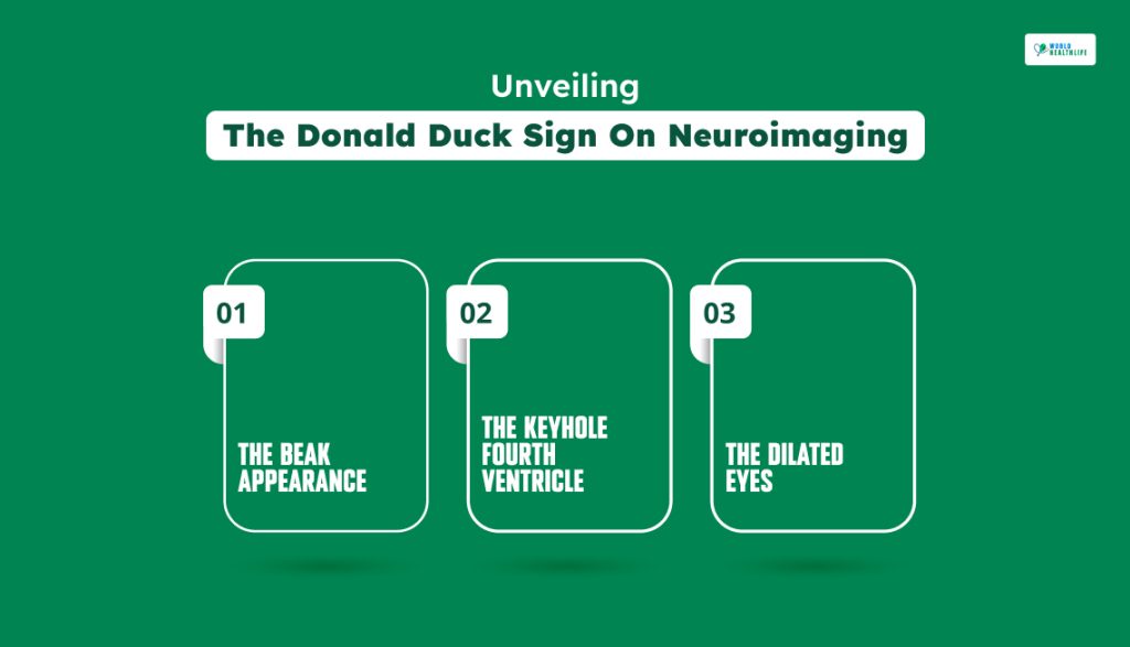 Unveiling The Donald Duck Sign On Neuroimaging