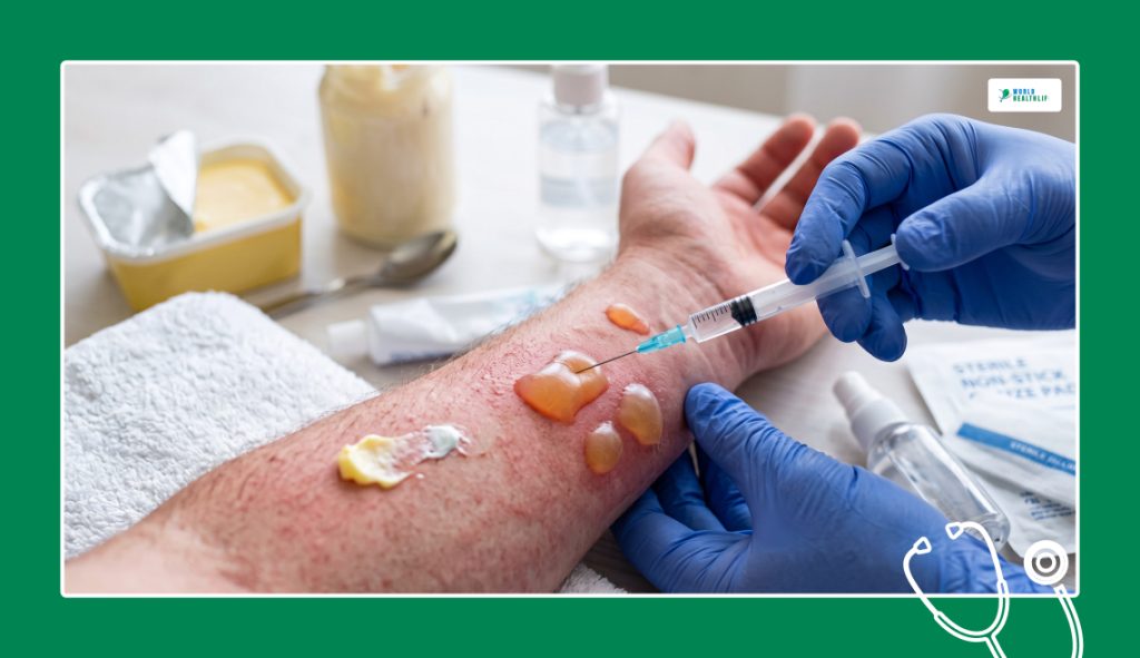 Vital Pre-Care Boundaries_ Essential Precautions For Safe Wound Closure