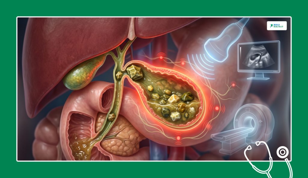 Common Issues Surrounding Your Gallbladder