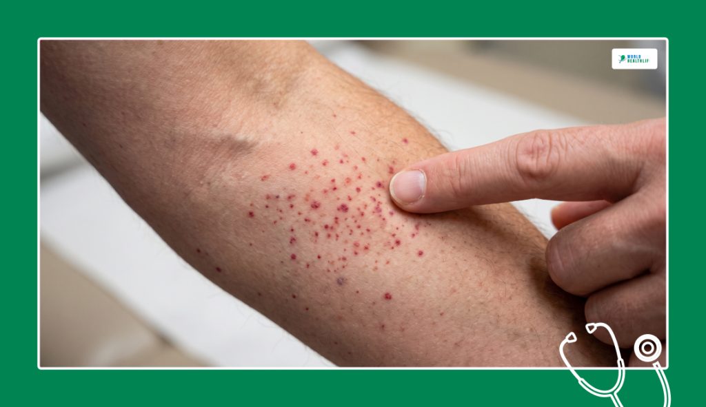 Investigating Small Red Spots On Skin That Do Not Itch