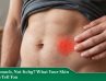 rash on stomach not itchy